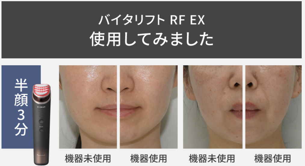 バイタリフトRFEXの使用前と
使用後の肌の比較
