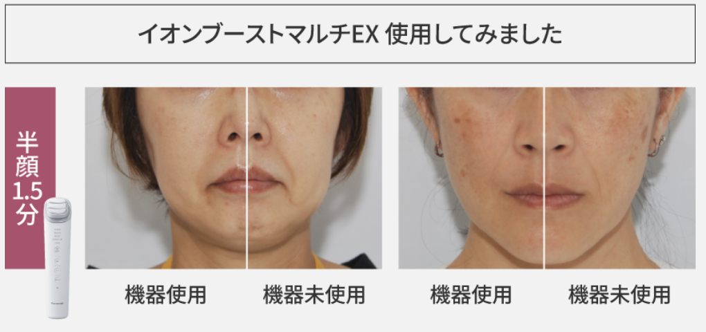 イオンブーストマルチEXの使用前後の画像比較