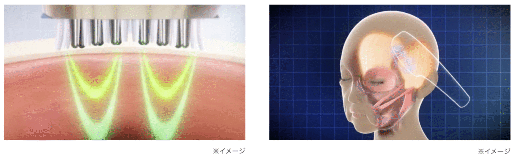 スカルプリフトプラスの
スカルプモード