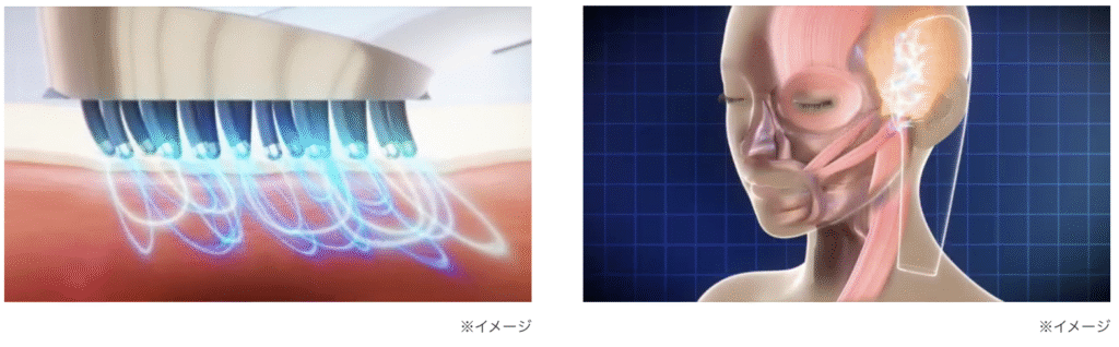 スカルプリフトプラスの
フェイスモード