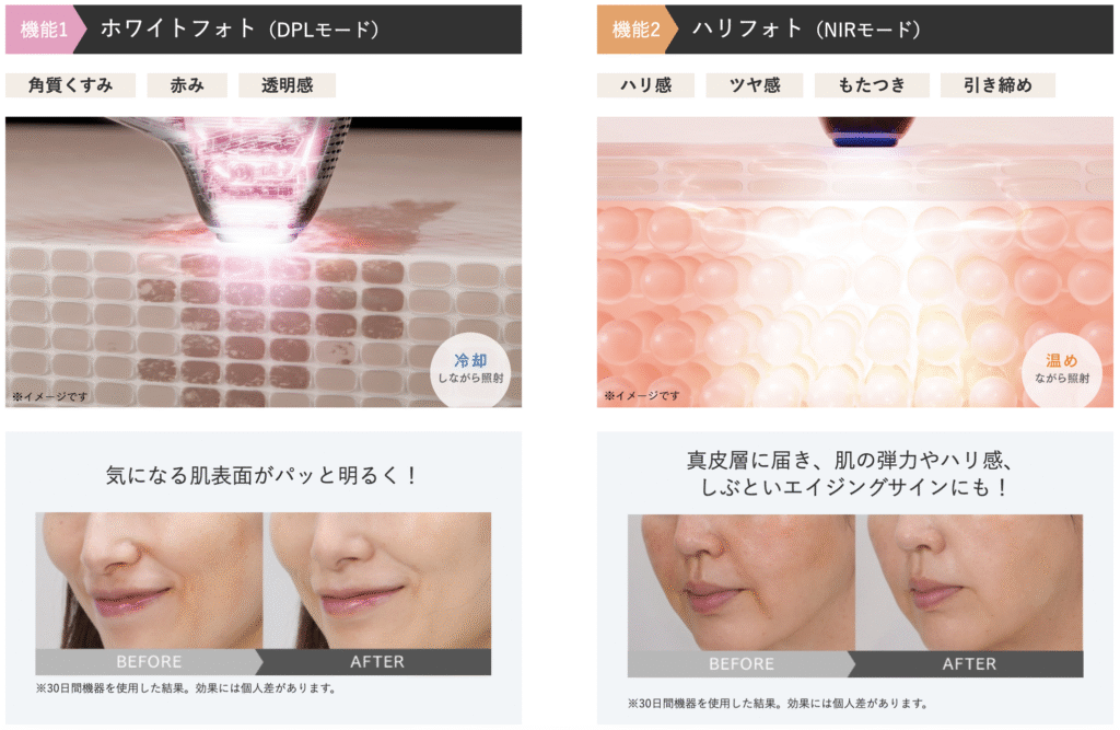 ミライワンはDPLとNIR、2種類の光で透明感やハリにアプローチ