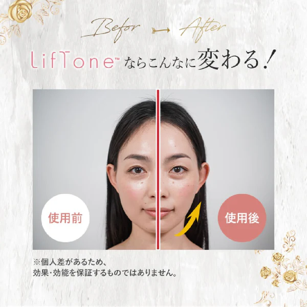 リフトーン美顔器の使用前後の比較画像