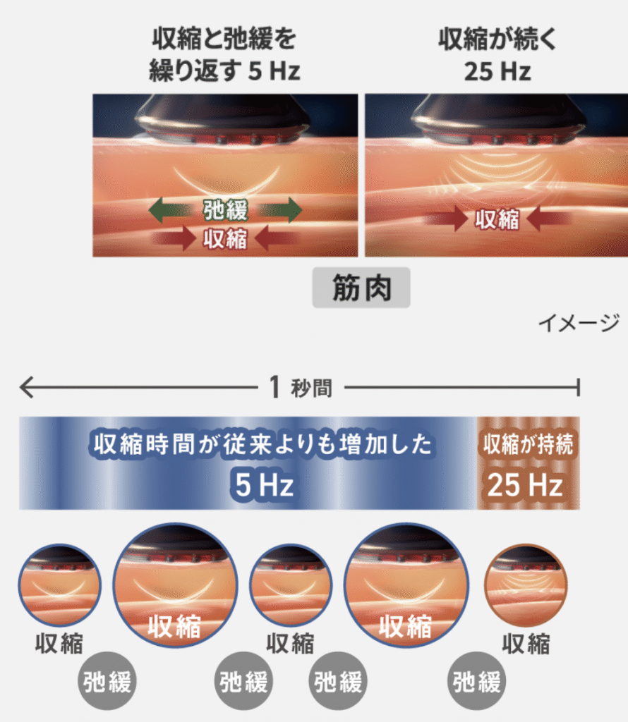 バイタリフトRFEXのデュアルダイナミックEMS