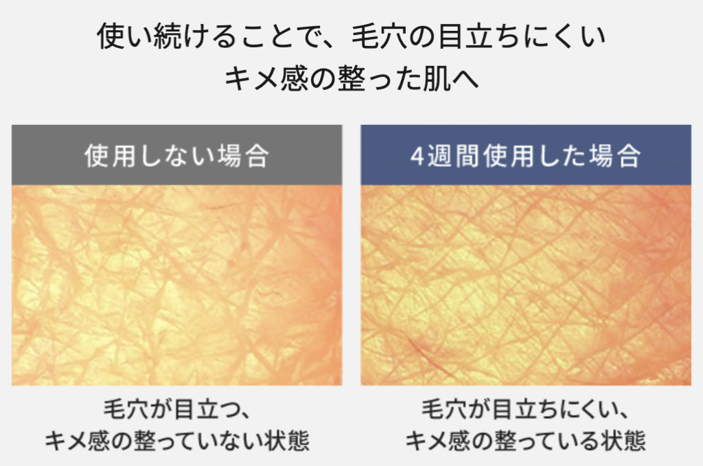 バイタリフトRFEXの使用前と
4週間使用した肌の比較