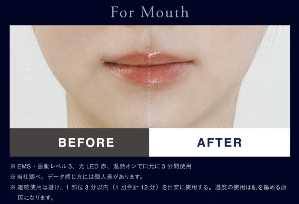 ニップラックス リファイン アイ(NIPLUX REFINE EYE)の使用前後(口)