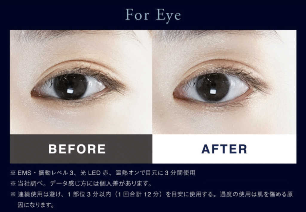 ニップラックス リファイン アイ(NIPLUX REFINE EYE)の使用前後(目)