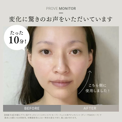 マイトレックス プルーヴの使用前後比較