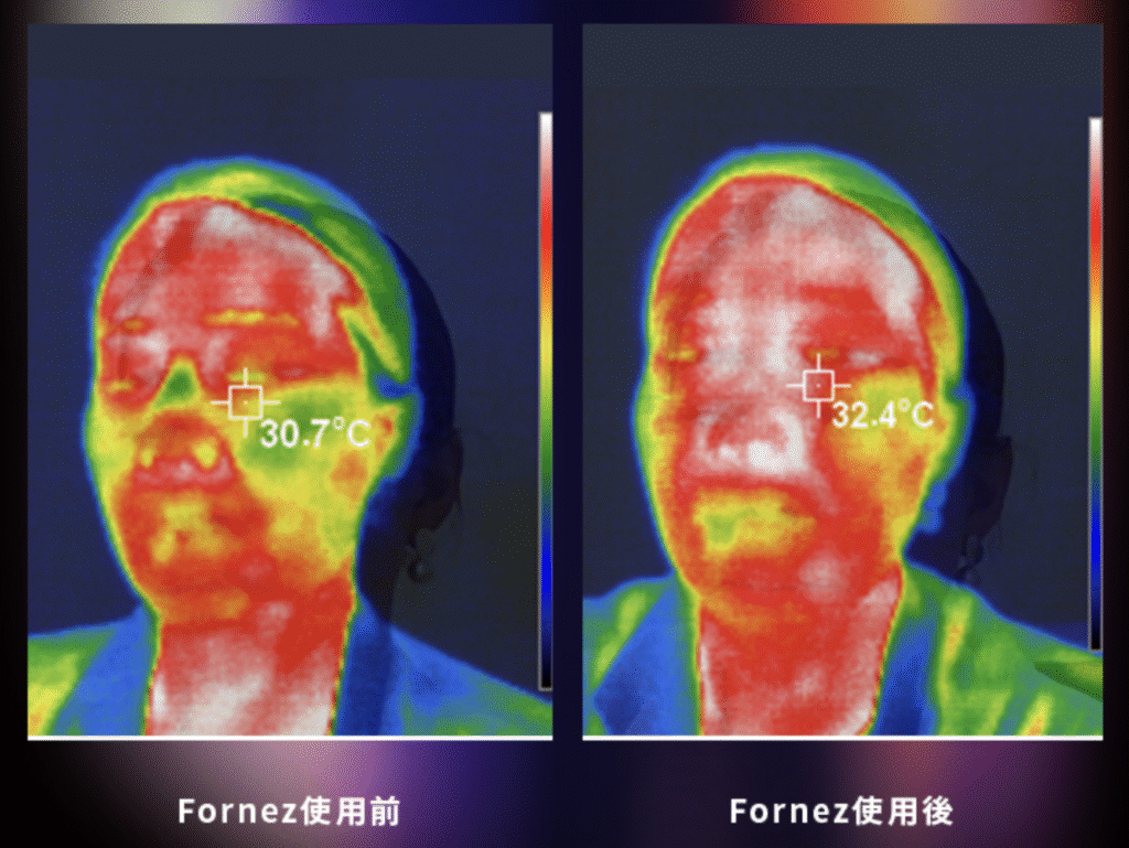 フォーネスの使用前後の比較画像