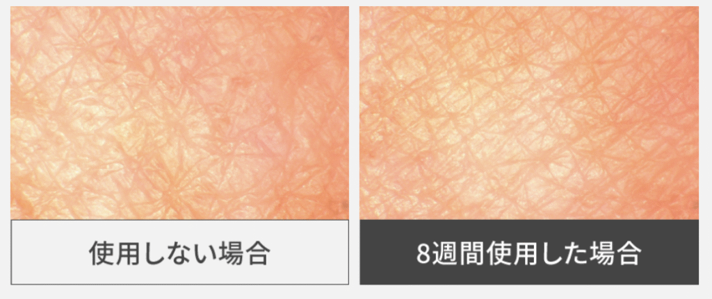 フォトブライトショットのビフォーアフター