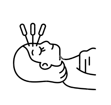 美容鍼