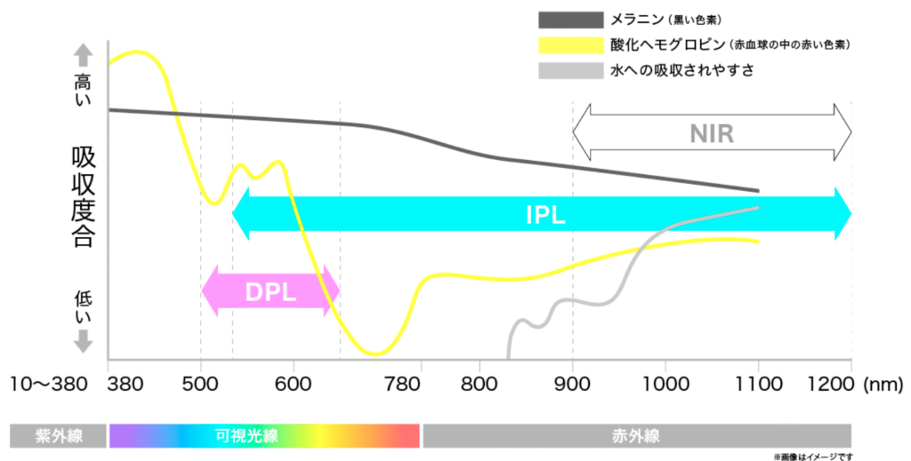 IPLとDPL