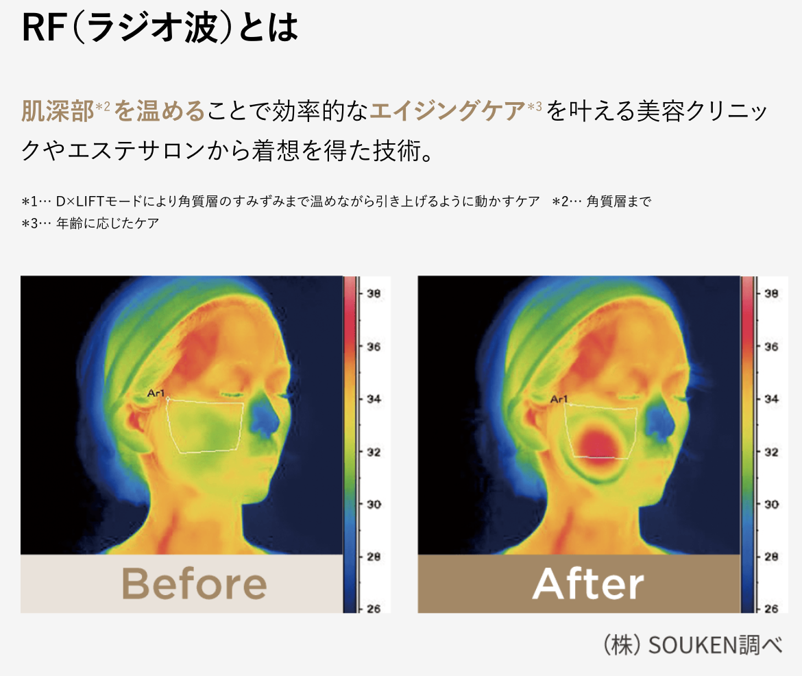 RFとは