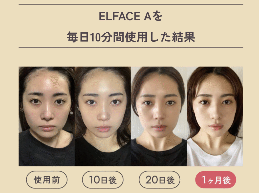 エルフェイスエーのビフォーアフター