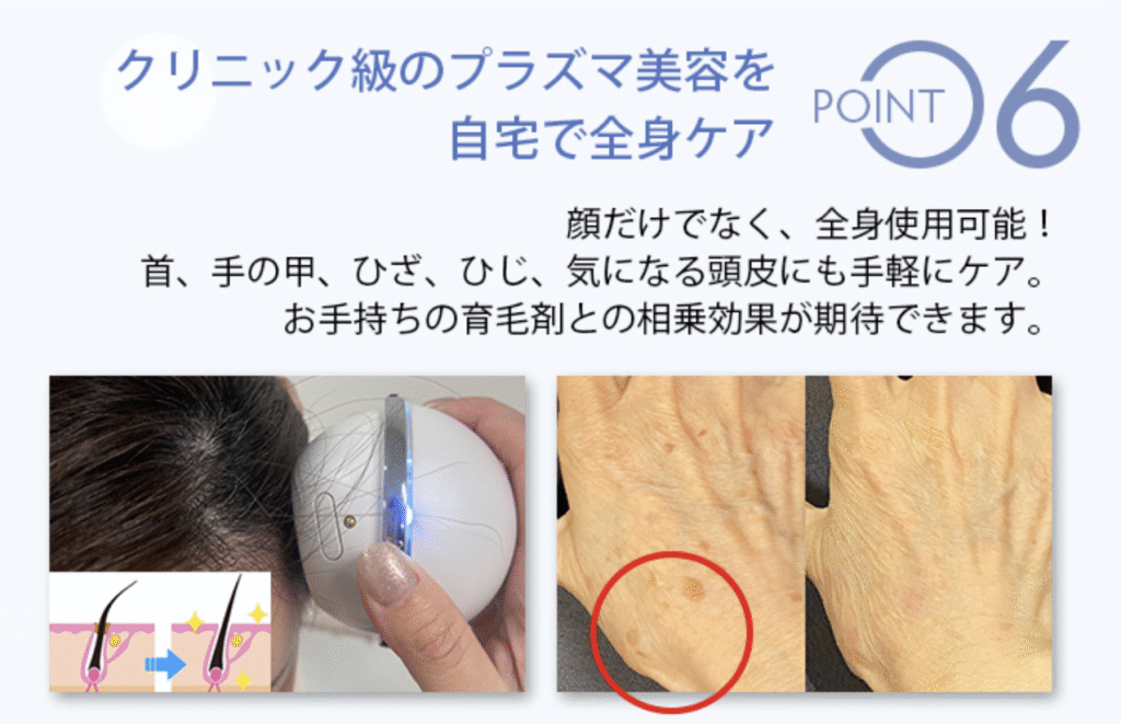 プラズマ美顔器Unは顔以外にも使用可能