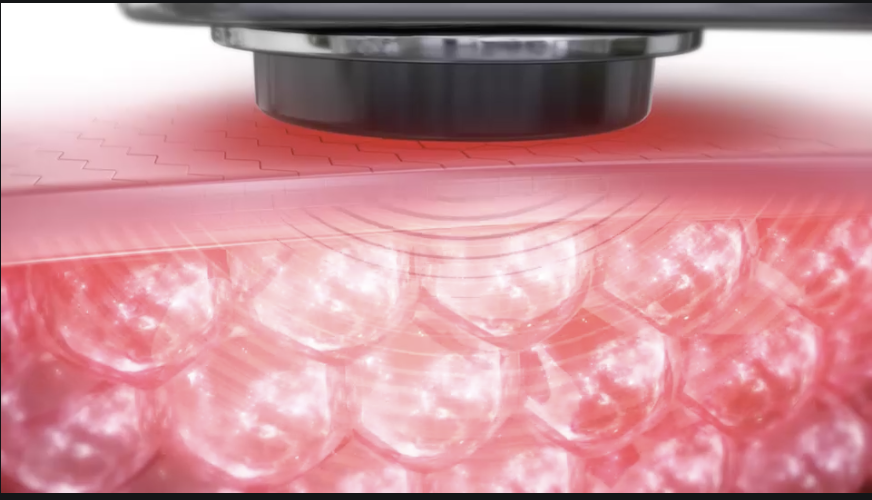 コラーゲンの生成が活性化されるイメージ