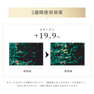NiZmirのRF多機能美顔器を2週間しようした後のコラーゲン量比較